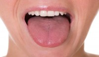 Losing tongue fat can lessen sleep disorder severity